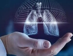 Когда обращаться в центр торакальной хирургии?